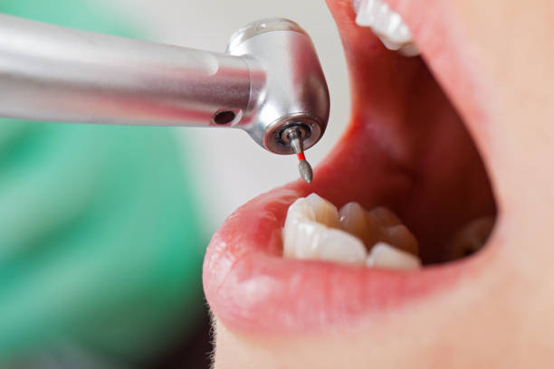 Best Emergency Gum Treatment in Abilene, KS